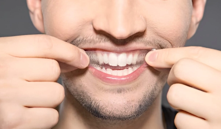 are whitening strips safe