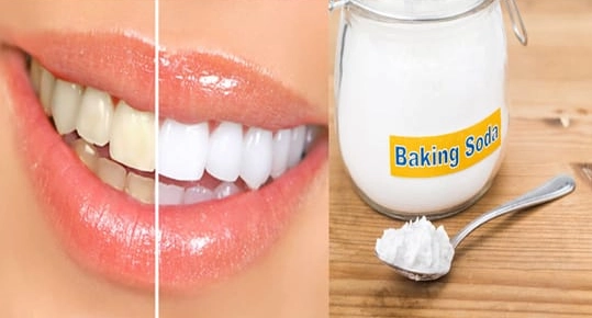 quick teeth whitening