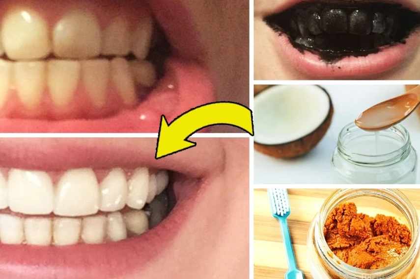 how to whiten teeth naturally