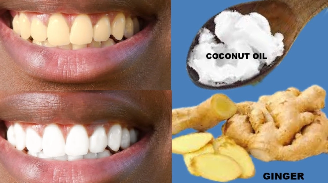 natural teeth whitening