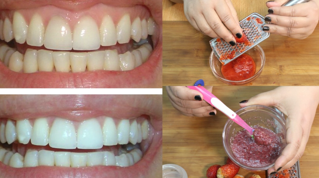 how to whiten teeth naturally