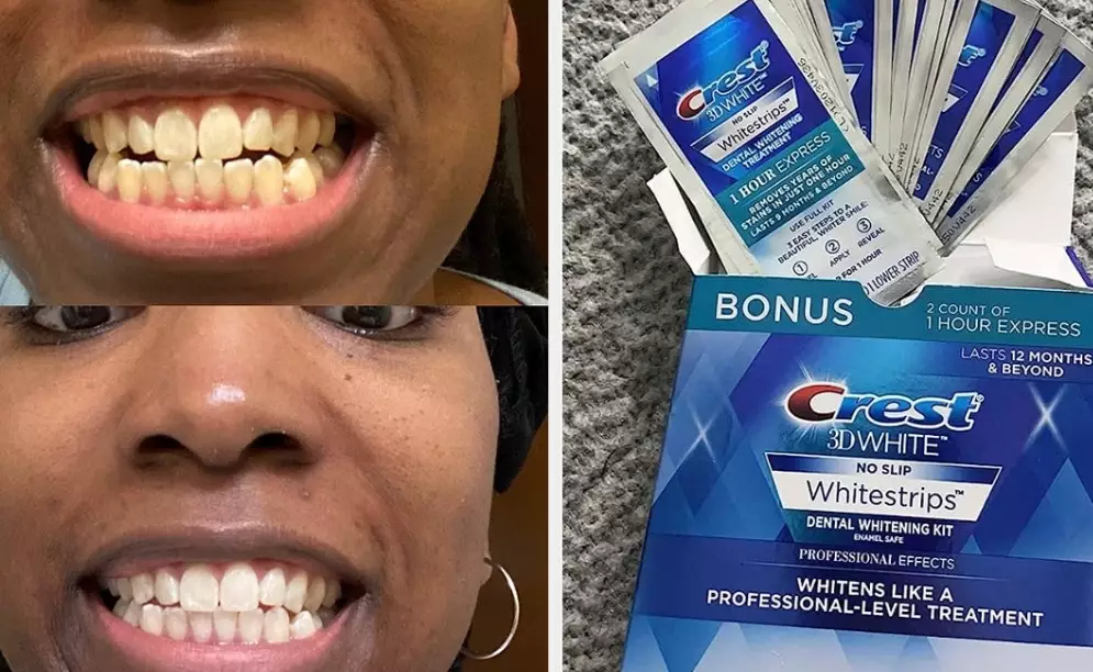 crest white strips results
