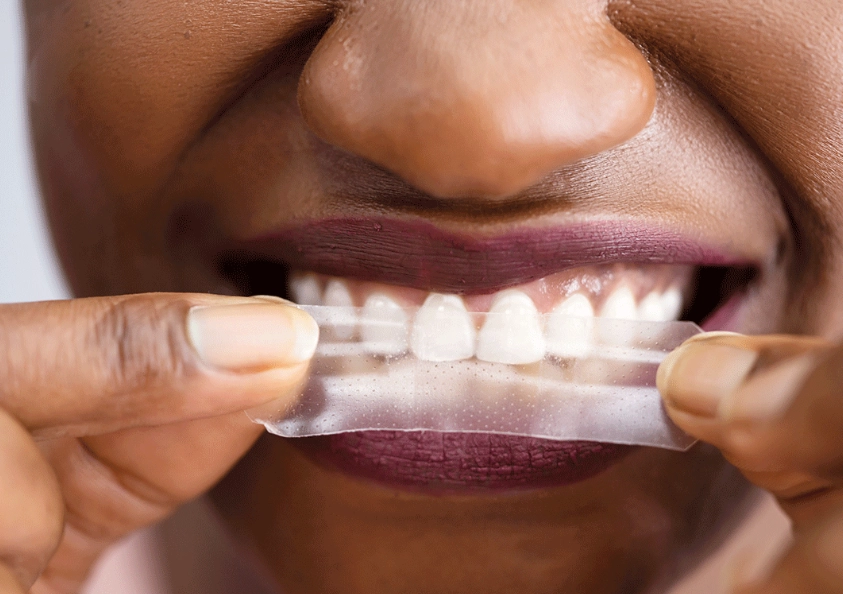 do crest white strips work