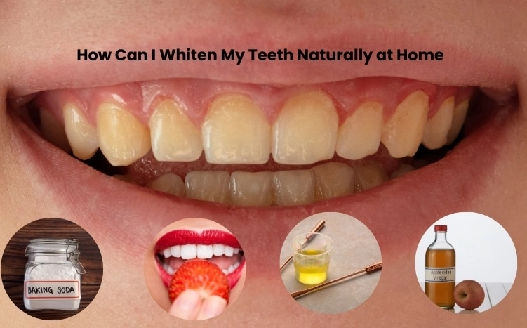 natural teeth whitening