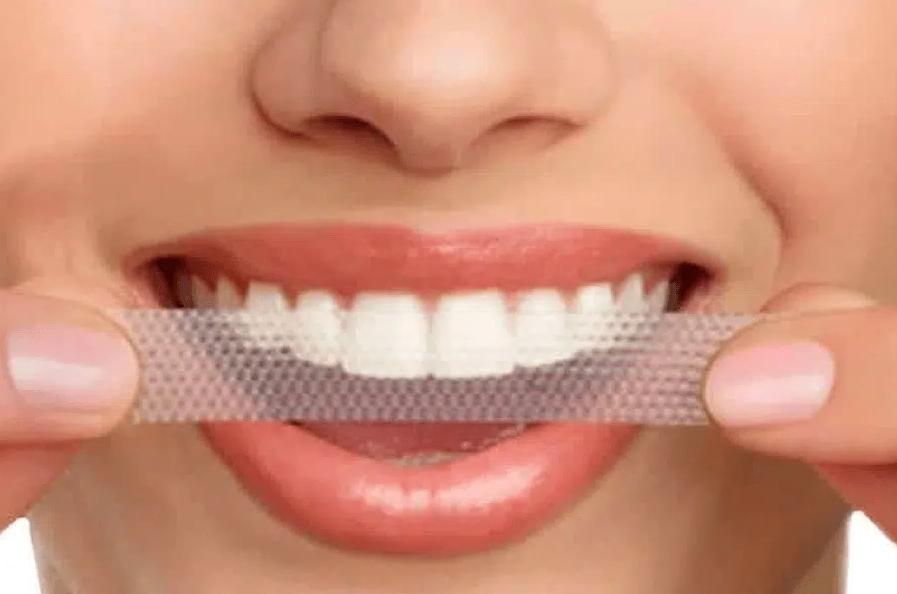 teeth whitening strips results